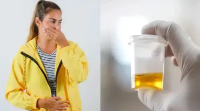 urine smell   ಮೂತ್ರ ವಾಸನೆ ಬರುತ್ತಿದೆಯೇ   ಈ ಸಮಸ್ಯೆ ಇರಬಹುದು    