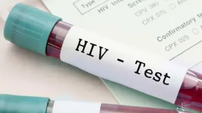 ಬಿಜೆಪಿ ನಾಯಕರು hiv ಪರೀಕ್ಷೆ ಮಾಡಿಸಿಕೊಂಡು   ಏಡ್ಸ್ ತಡೆಗೆ ಸಹಕರಿಸಬೇಕು   ಕಾಂಗ್ರೆಸ್ ಟ್ವೀಟ್   